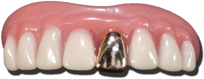 Fausses dents Bling Bling - Adulte - Billy Bob
