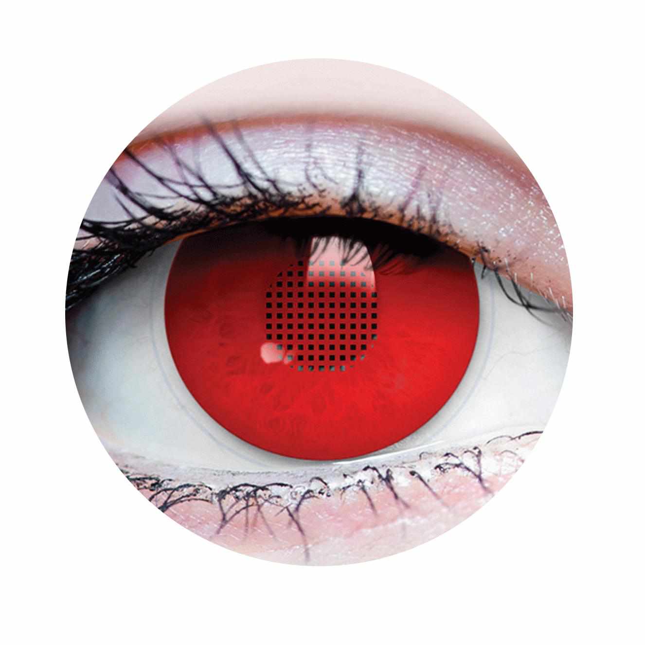 Eyes – X-ray