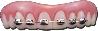 Fausses dents avec broches - Adulte - Billy Bob